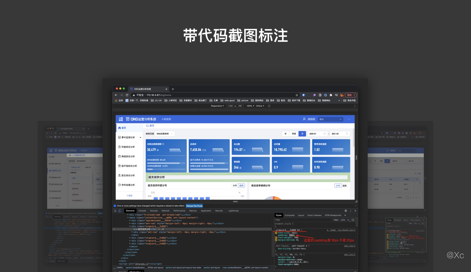 最后一道防线！五步提升 UI 交互验收效率（附验收模板）