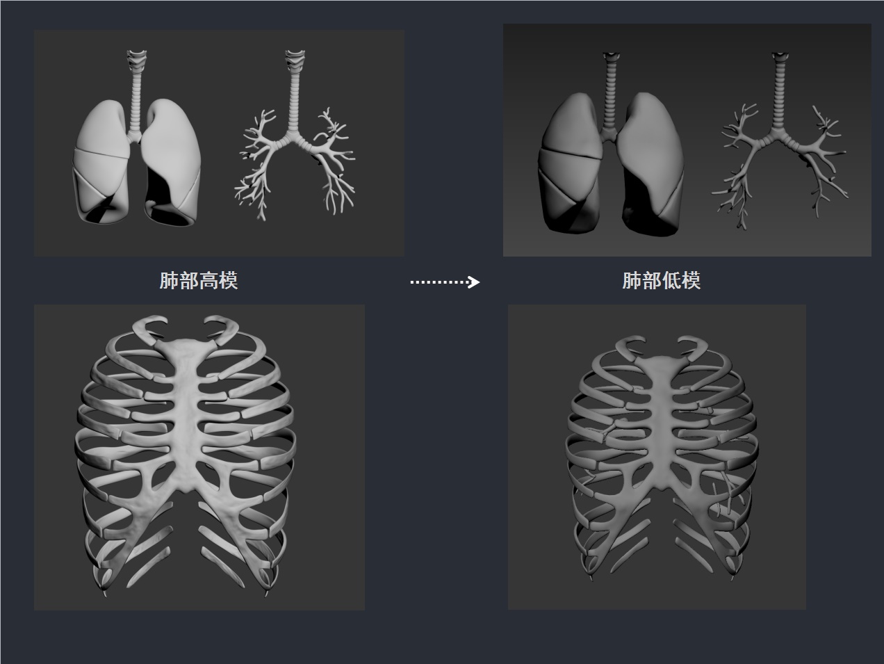 专业的设计流程是怎样的？来看腾讯的医学可视化探索案例！