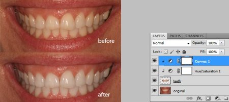 Natural Teeth Whitening